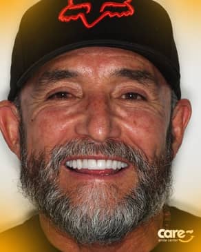 Slider image (3) Care Smile Center